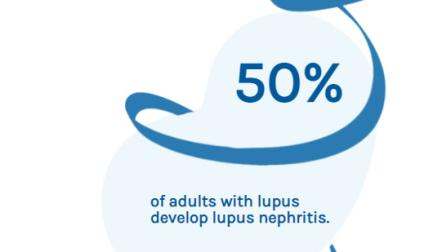Kidney with a ribbon - 50% of adults with lupus develop lupus nephritis