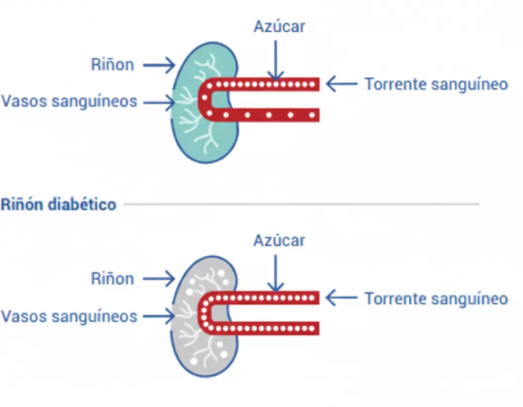 CKD toolkit Spanish photo 3