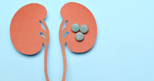 cut out drawing of two kidneys with three pills on top of one of the kidneys