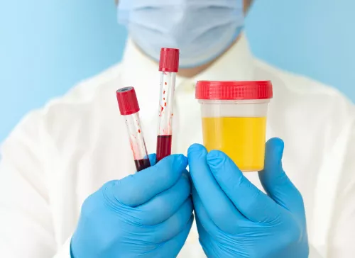 HCP holding two blood samples and a urine sample