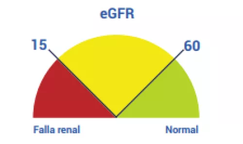 CKD toolkit Spanish photo 5