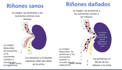 kidney spanish
