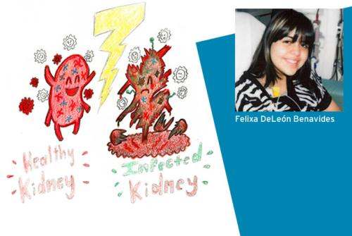 a Healthy kidney versus infected kidney artwork next to a photo of Felixa Deleón Benavides