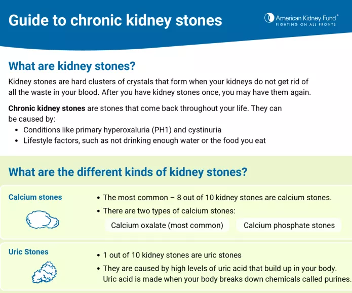 Kidney stone guide