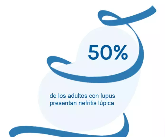 Looped kidney swirl - Spanish