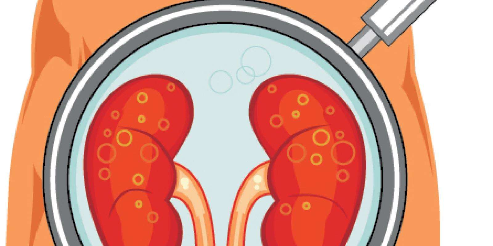 cartoon kidney magnified