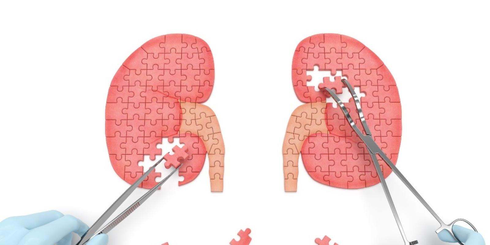 kidney puzzle