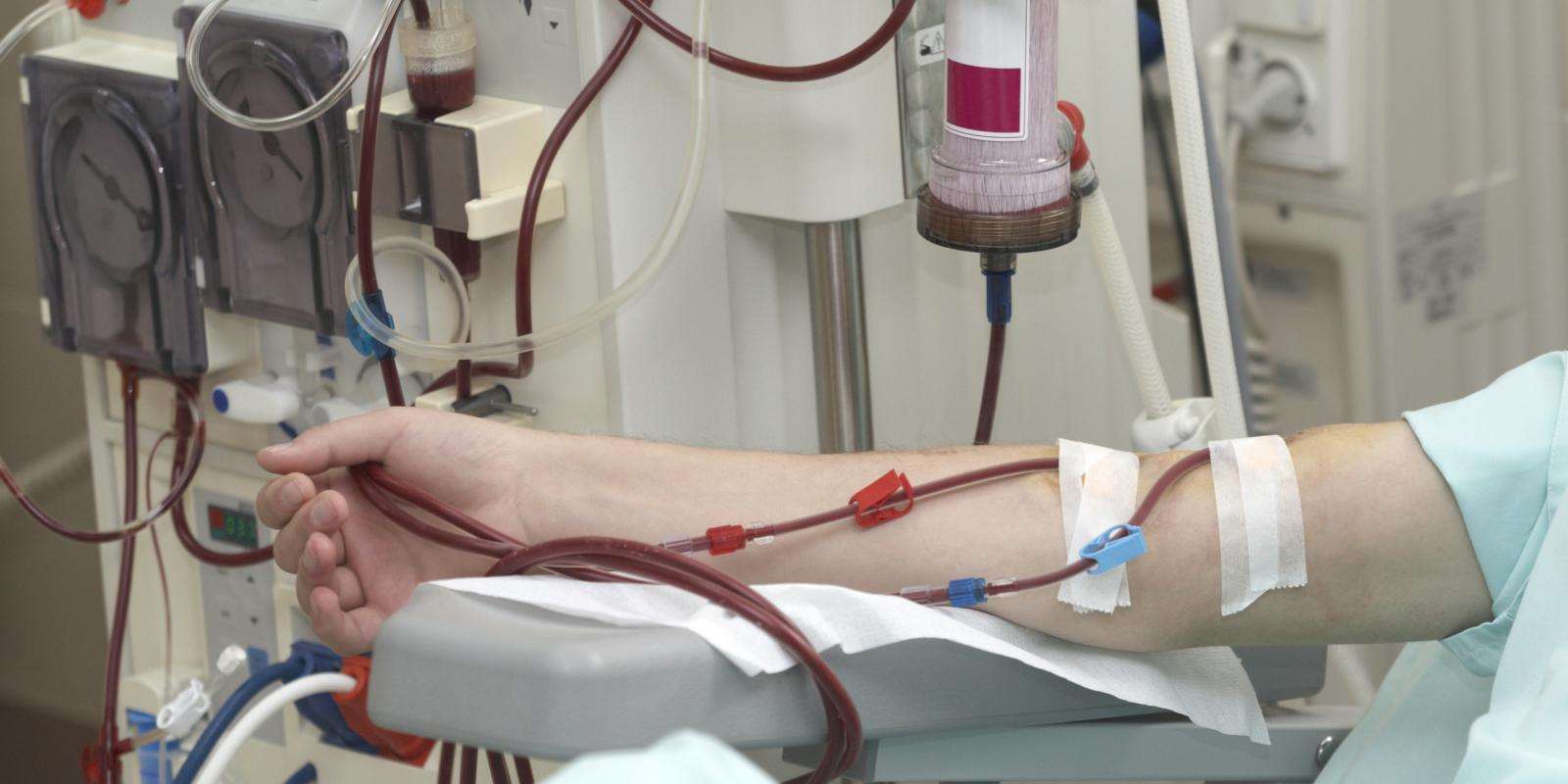 dialysis machine arm