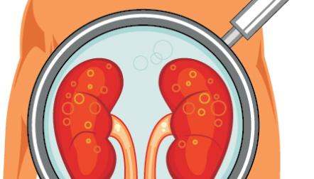 cartoon kidney magnified