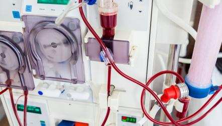 dialysis machine 2