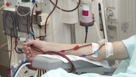 dialysis machine arm